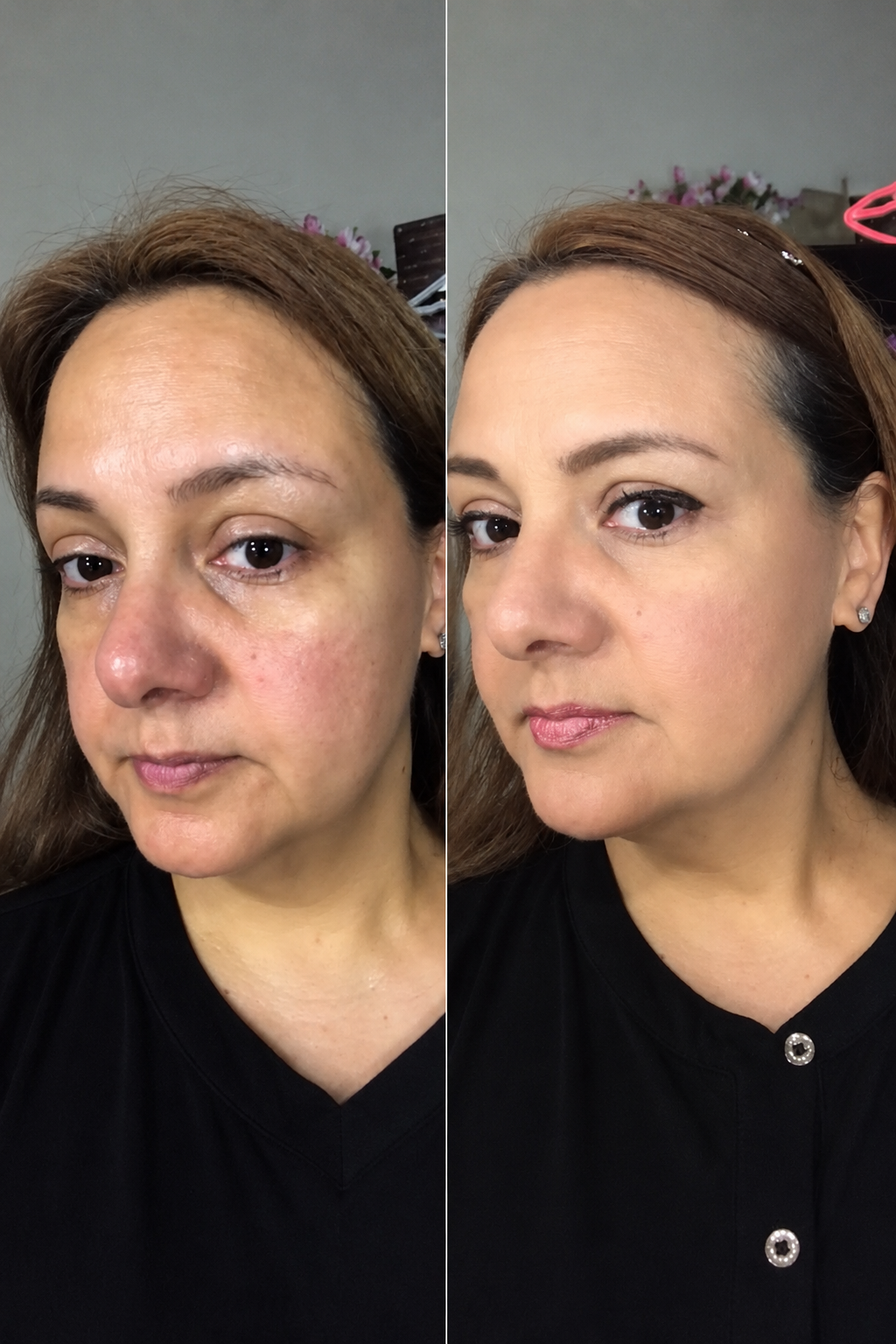 ¡Increíble transformación para mi piel!